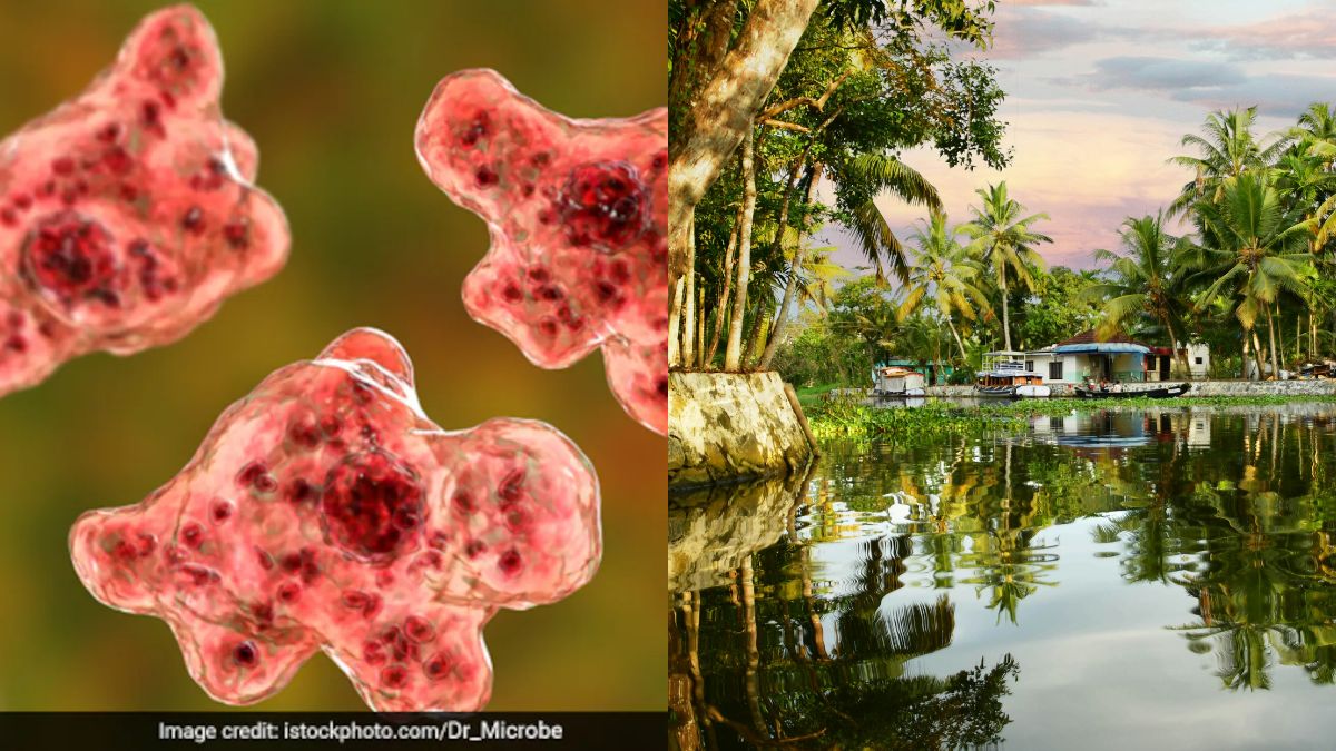 'Brain-Eating Amoeba' Kills 19 In Kerala. How It Spreads, How To Stay Safe