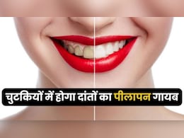 गंदे पीले दांतों को मोती सा चमका देंगी रसोई की ये चीजें, देखने के बाद नहीं होगा खुद की ही आंखों पर यकीन