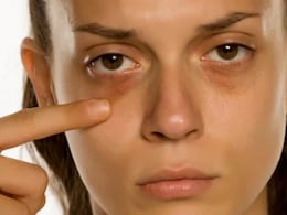 Dark circle हटाने का आसान घरेलू नुस्खा, खाने की ये 2 चीजें आंखों के काले घेरे कर सकती हैं चुटकियों में हल्का