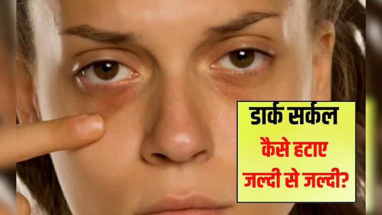 आंखों के नीचे काले घेरे किसकी कमी से होते हैं? आँखों के नीचे के काले गड्ढों को कैसे ठीक करें, जान‍िए यहां