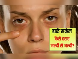 आंखों के नीचे काले घेरे किसकी कमी से होते हैं? आँखों के नीचे के काले गड्ढों को कैसे ठीक करें, जानिए यहां आंखों के नीचे काले घेरे किसकी कमी से होते हैं? आँखों के नीचे के काले गड्ढों को कैसे ठीक करें, जानिए यहां