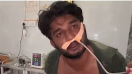Rajasthan: सैलरी न मिलने पर जूनियर असिस्टेंट ने खाया कीटनाशक, BDO ने आरोपों को बताया निराधार