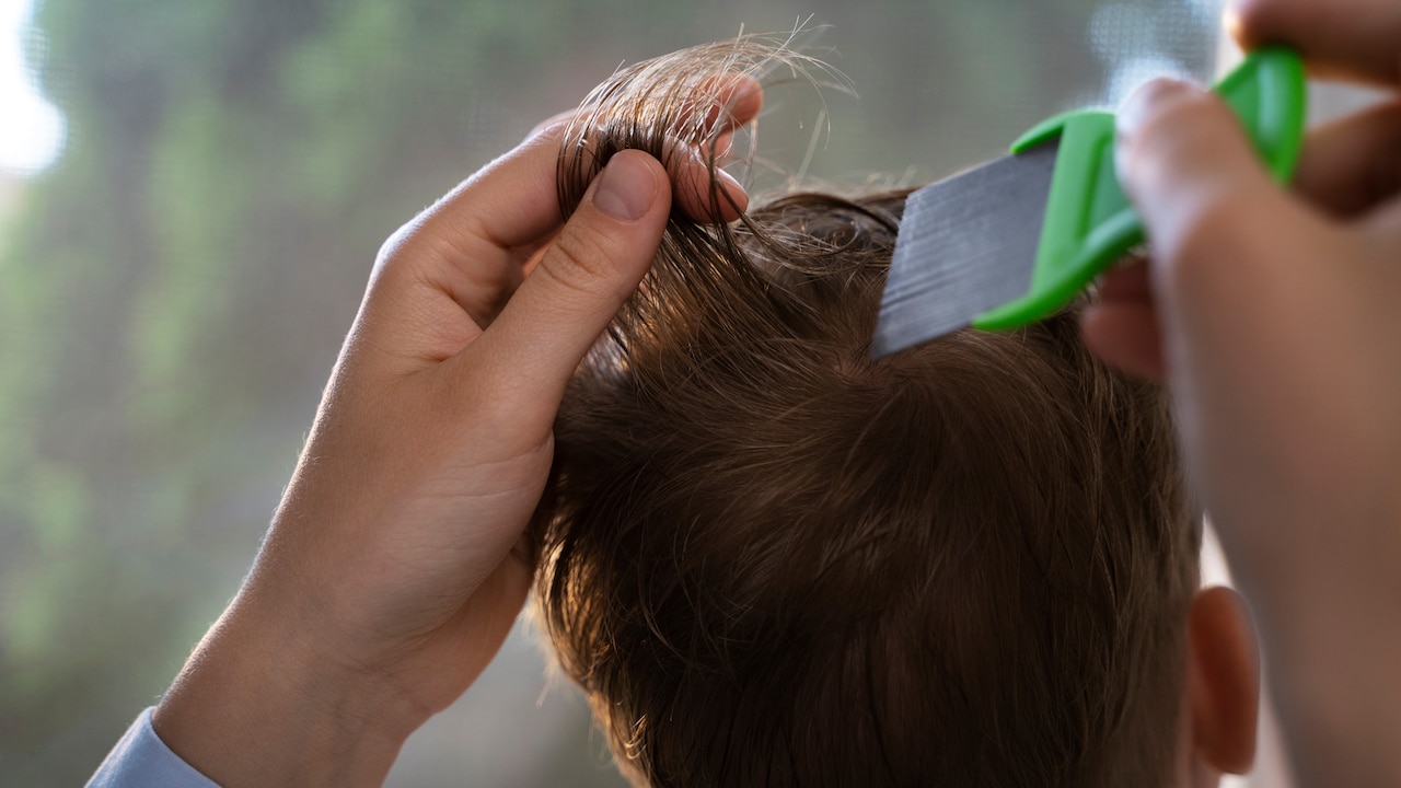 Safe Lice Treatment For Kids: What To Know Before Using Anti-Lice Machine