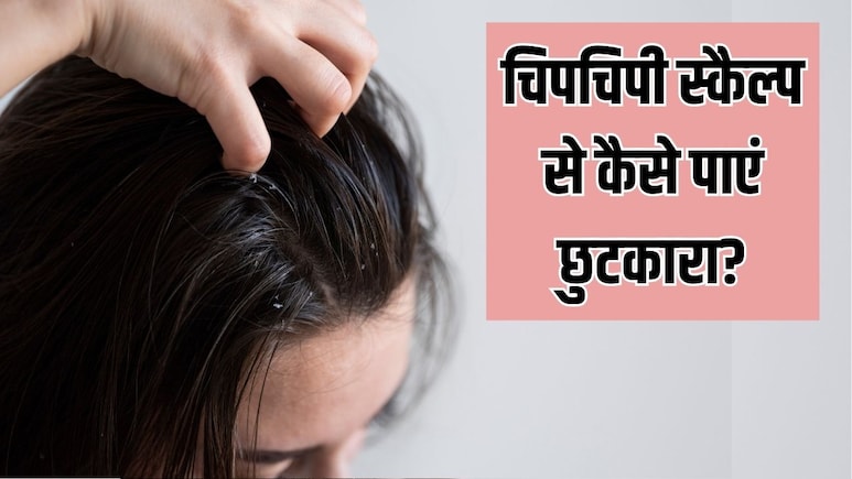 हेयर वॉश के 2 दिन बाद ही चिपचिपे हो जाते हैं बाल? डर्मेटोलॉजिस्ट ने बताया क्यों होता है ऐसा, जानें ऑयली स्कैल्प से कैसे पाएं छुटकारा