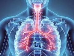 Expert Busts Common Myths About Lung Cancer
