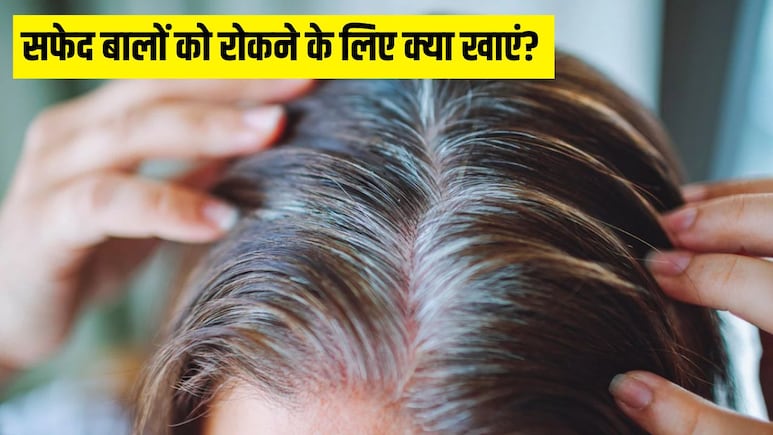 सफेद बाल रोकने के लिए क्या खाएं? डॉक्टर ने बताया इन 4 चीजों से बुढ़ापे तक काले रहेंगे बाल