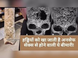 अनसेफ सेक्स से होने वाली एक बीमारी, जो हड्डियों को गला देती है, बन सकती है मौत की वजह अनसेफ सेक्स से होने वाली एक बीमारी, जो हड्डियों को गला देती है, बन सकती है मौत की वजह
