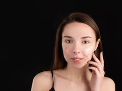 Acne Flare-Ups High During Festive Season? Skin Specialist Explains Why, Shares Tips