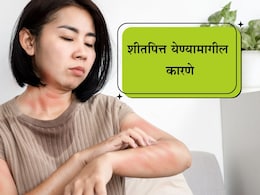 Hives Remedy: शरीरावर शीतपित्त आल्यास काय करावे? समस्येमागील ही आहेत मुख्य कारणं Hives Remedy: शरीरावर शीतपित्त आल्यास काय करावे? समस्येमागील ही आहेत मुख्य कारणं