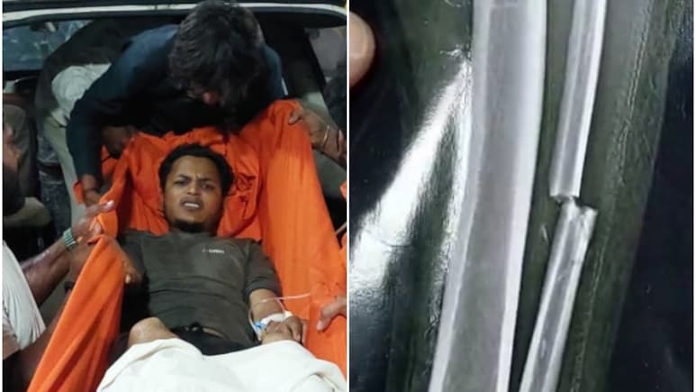 Rajasthan: विधायक को वादा याद दिलाने का अंजाम! पानी मांगने पर युवक के दोनों पैर तोड़े, कांग्रेस ने बनाया मुद्दा Rajasthan: विधायक को वादा याद दिलाने का अंजाम! पानी मांगने पर युवक के दोनों पैर तोड़े, कांग्रेस ने बनाया मुद्दा