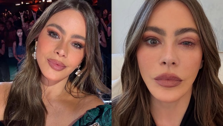 "Craziest Eye Allergy" Forces Sofia Vergara To Skip Emmy Awards 2025
