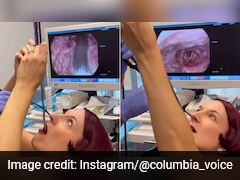 Watch: Breathtaking Video Shows Inside Of US Woman's Throat As She Swallows Sword