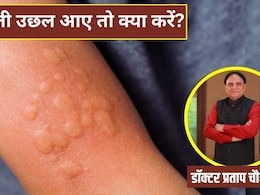 शरीर में पित्ती उछल आए तो क्या करना चाहिए? शरीर में पित्ती उछल आए तो क्या करना चाहिए?