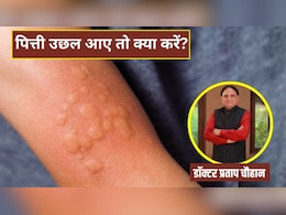 शरीर में पित्ती उछल आए तो क्या करना चाहिए?