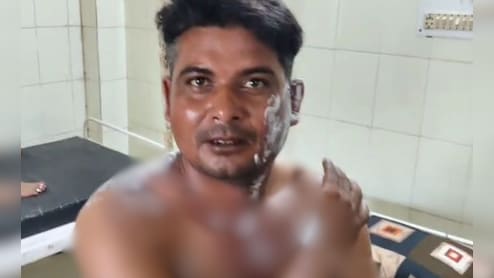 गहरी नींद में सो रहा था पति, पत्नी ने खौलता पानी उड़ेला, जब जान बचाकर भागा तो सिर पर दे मारा हथौड़ा
