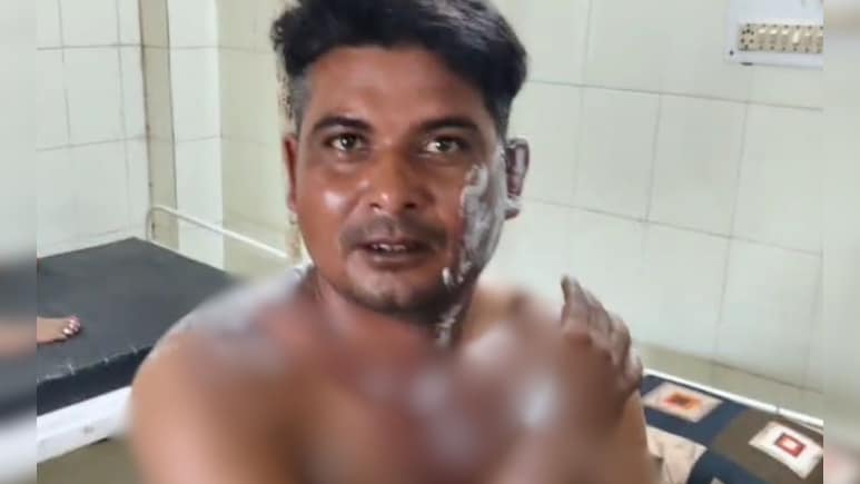 गहरी नींद में सो रहा था पति, पत्नी ने खौलता पानी उड़ेला, जब जान बचाकर भागा तो सिर पर दे मारा हथौड़ा