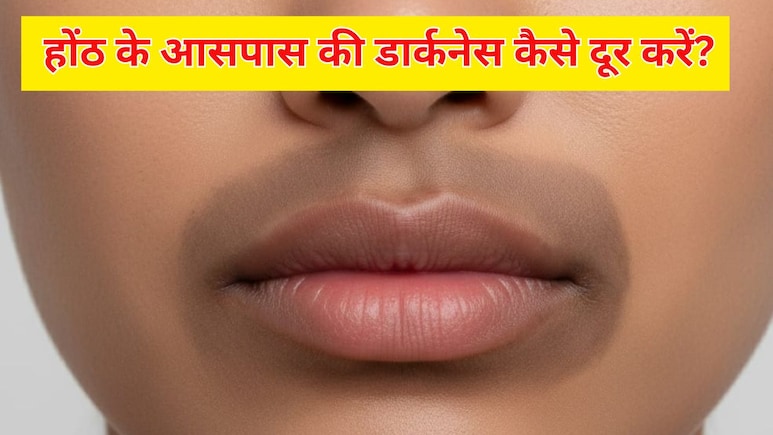 होंठों के आसपास की स्किन डार्क क्यों हो जाती है? एक्सपर्ट से जानें इसे ठीक करने के लिए क्या करें
