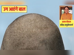 'जहां चाहते हैं बाल उगाना, बस वहीं लगाना', आयुर्वेदिक डॉक्टर की कड़ी चेतावनी, घर पर सिर्फ 2 मिनट में हो जाएगा तैयार 'जहां चाहते हैं बाल उगाना, बस वहीं लगाना', आयुर्वेदिक डॉक्टर की कड़ी चेतावनी, घर पर सिर्फ 2 मिनट में हो जाएगा तैयार