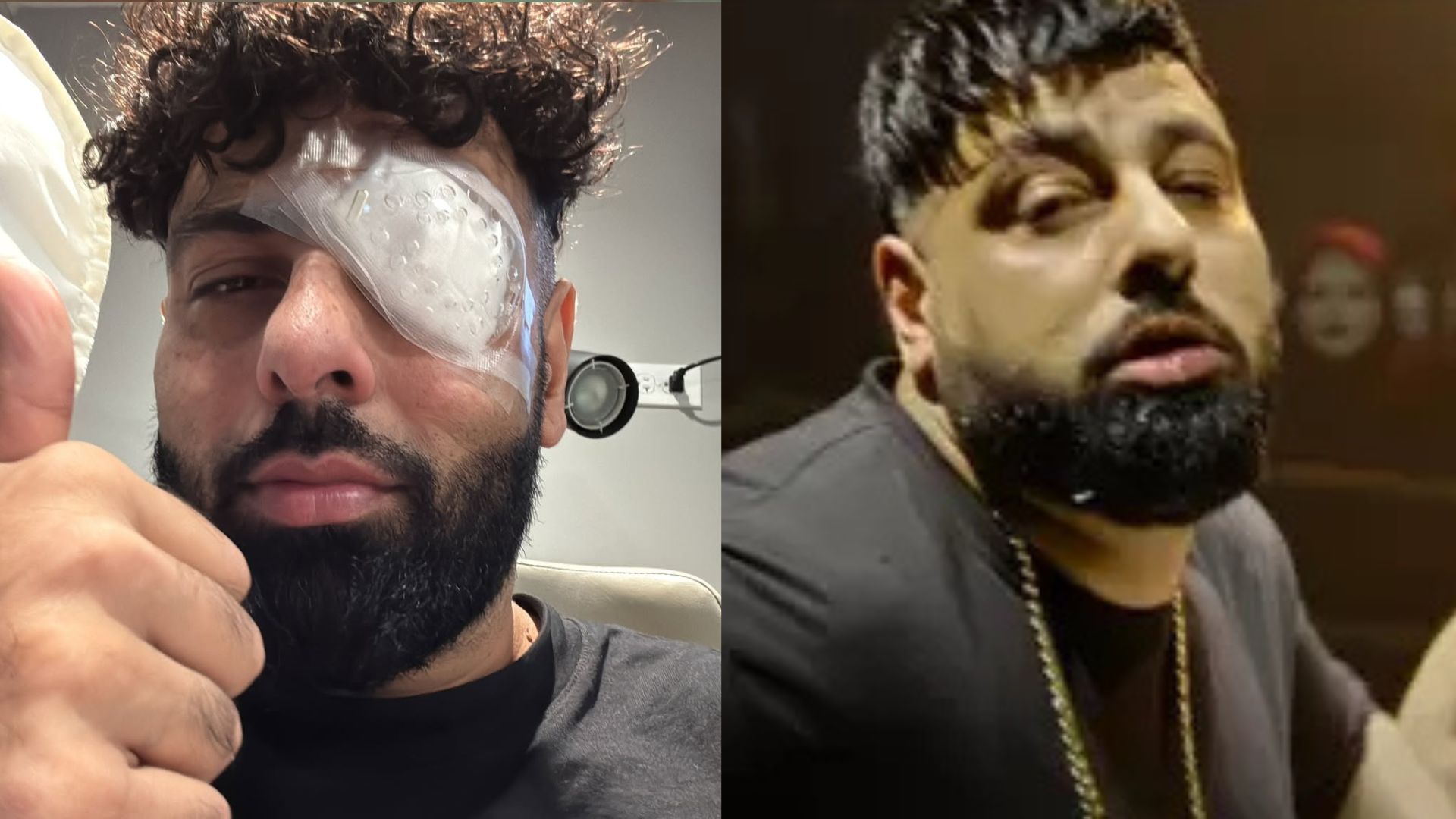 Badshah Uses This <i>Ba***ds Of Bollywood</i> Reference To Reveal His Eye Injury