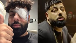 Badshah Uses This <i>Ba***ds Of Bollywood</i> Reference To Reveal His Eye Injury