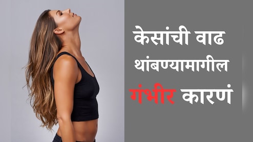 Hair Growth Tips: कोणत्या व्हिटॅमिनच्या कमतरतेमुळे केसांची वाढ थांबते? न्युट्रिशनिस्टने 5 ब्लड टेस्ट करण्याचा दिला सल्ला