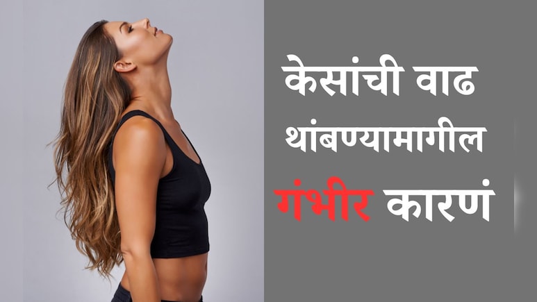 Hair Growth Tips: कोणत्या व्हिटॅमिनच्या कमतरतेमुळे केसांची वाढ थांबते? तज्ज्ञांनी दिला 5 टेस्ट करण्याचा सल्ला Hair Growth Tips: कोणत्या व्हिटॅमिनच्या कमतरतेमुळे केसांची वाढ थांबते? तज्ज्ञांनी दिला 5 टेस्ट करण्याचा सल्ला