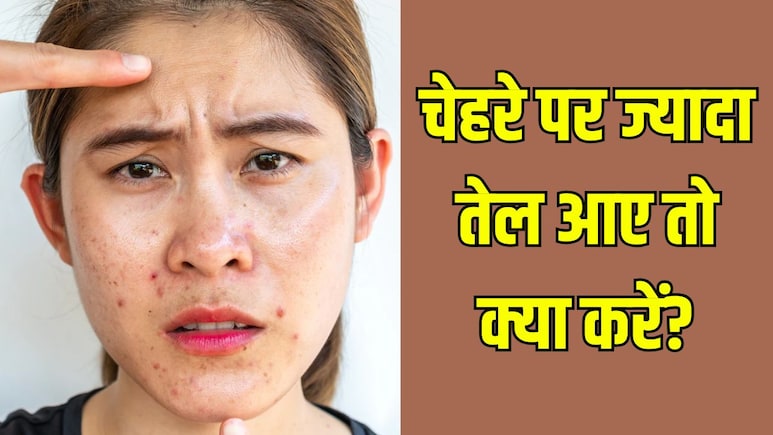 चेहरे पर तेल आना कैसे बंद करें? डर्माटोलॉजिस्ट ने बताया हमेशा चिपचिपा रहता है चेहरा तो कर लें बस ये 3 काम