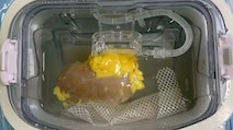 Scientists Create One Kidney That Can Match Any Patient, No Matter The Blood Type