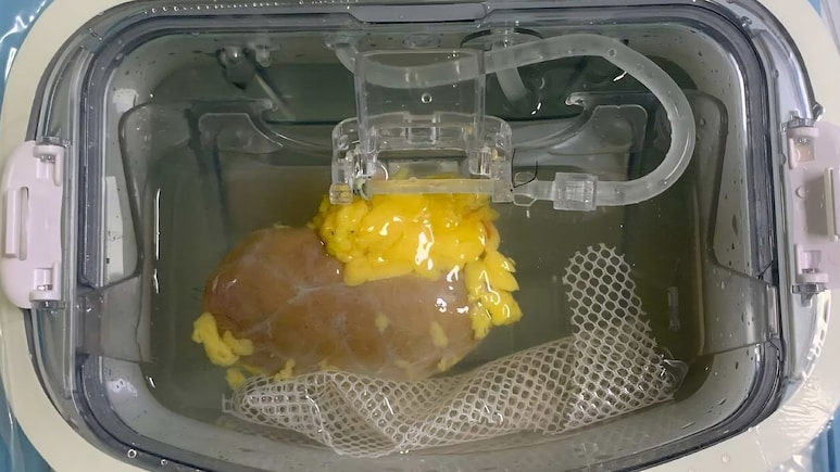 Scientists Create One Kidney That Can Match Any Patient, No Matter The Blood Type