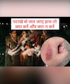 Diwali 2025: दीवाली में पटाखे छुड़ाते समय जल जाए हाथ तो तुरंत करें ये काम, नहीं पड़ेंगे फफोले और निशान