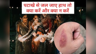Diwali 2025: दीवाली में पटाखे छुड़ाते समय जल जाए हाथ तो तुरंत करें ये काम, नहीं पड़ेंगे फफोले और निशान