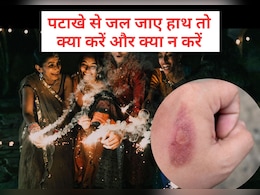 Diwali 2025: दीवाली में पटाखे छुड़ाते समय जल जाए हाथ तो तुरंत करें ये काम, नहीं पड़ेंगे फफोले और निशान Diwali 2025: दीवाली में पटाखे छुड़ाते समय जल जाए हाथ तो तुरंत करें ये काम, नहीं पड़ेंगे फफोले और निशान