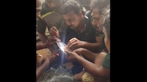 Tamil Nadu Toddler's Finger, Stuck In Idli Tray, Removed In 90-Minute Op