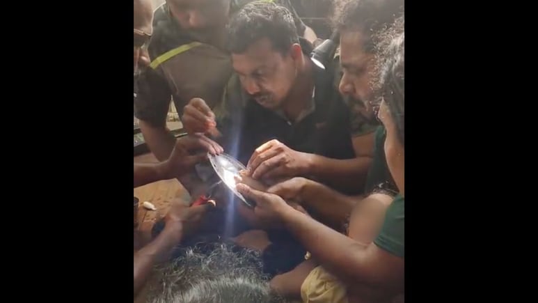 Tamil Nadu Toddler's Finger, Stuck In Idli Tray, Removed In 90-Minute Op Tamil Nadu Toddler's Finger, Stuck In Idli Tray, Removed In 90-Minute Op