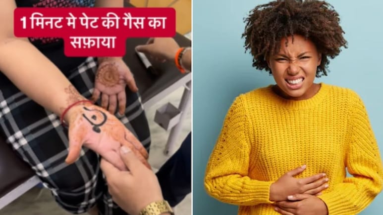 कुछ भी खाते ही पेट में बन जाती है गैस तो हथेली के इस पॉइंट को दबाएं, झट से निकल आएगी सारी बाहर, एक्सपर्ट से जानिए कैसे कुछ भी खाते ही पेट में बन जाती है गैस तो हथेली के इस पॉइंट को दबाएं, झट से निकल आएगी सारी बाहर, एक्सपर्ट से जानिए कैसे