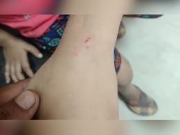 पड़ोसी के आंगन में अमरूद गिराने की खौफनाक सजा! 7 साल के बच्चे को बाल पकड़कर पीटा, फिर कुत्ते से कटवाया पड़ोसी के आंगन में अमरूद गिराने की खौफनाक सजा! 7 साल के बच्चे को बाल पकड़कर पीटा, फिर कुत्ते से कटवाया