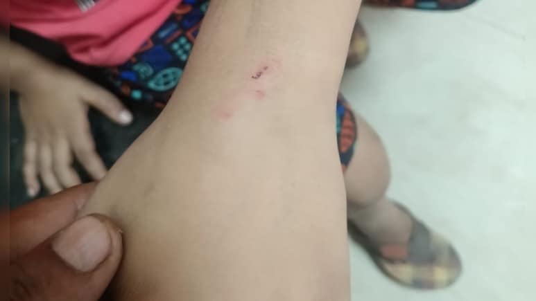 पड़ोसी के आंगन में अमरूद गिराने की खौफनाक सजा! 7 साल के बच्चे को बाल पकड़कर पीटा, फिर कुत्ते से कटवाया पड़ोसी के आंगन में अमरूद गिराने की खौफनाक सजा! 7 साल के बच्चे को बाल पकड़कर पीटा, फिर कुत्ते से कटवाया