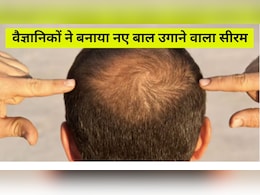 वैज्ञानिकों का दावा, सिर्फ 20 दिन में गंजी खोपड़ी पर उगेंगे नए बाल, हेयर ग्रोथ के लिए बनाया चमत्कारी सीरम वैज्ञानिकों का दावा, सिर्फ 20 दिन में गंजी खोपड़ी पर उगेंगे नए बाल, हेयर ग्रोथ के लिए बनाया चमत्कारी सीरम