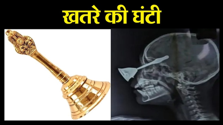 Bilaspur News: पूजा की घंटी बनी जानलेवा; आंख से होते हुए दिमाग में घुसी, जानिए कैसे हुए मासूम के साथ हादसा Bilaspur News: पूजा की घंटी बनी जानलेवा; आंख से होते हुए दिमाग में घुसी, जानिए कैसे हुए मासूम के साथ हादसा