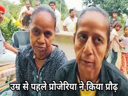 दुनिया भर में हैं इस दुर्लभ बीमारी के 500 मरीज, MP में भी मिले चार, जिन्हें जवानी में आ रहा बुढ़ापा! दुनिया भर में हैं इस दुर्लभ बीमारी के 500 मरीज, MP में भी मिले चार, जिन्हें जवानी में आ रहा बुढ़ापा!