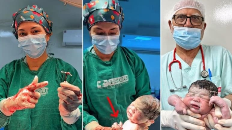 गर्भनिरोधक कॉइल भी न रोक सका जन्म, पैदा होते ही हाथ में Contraceptive Coil पकड़े दिखा बच्चा, डॉक्टर भी हैरान