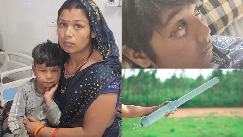 इंस्टाग्राम के वायरल 'कार्बाइड गन' ट्रेंड ने मप्र से बिहार तक छीन लीं बच्चों की आंखों की रोशनी