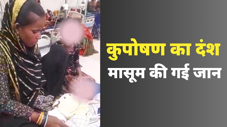 Malnutrition Deaths in MP: 8 और 12 रुपये की ‘पोषण व्यवस्था’ के बीच कुपोषण से दम तोड़ गया मासूम हुसैन Malnutrition Deaths in MP: 8 और 12 रुपये की ‘पोषण व्यवस्था’ के बीच कुपोषण से दम तोड़ गया मासूम हुसैन