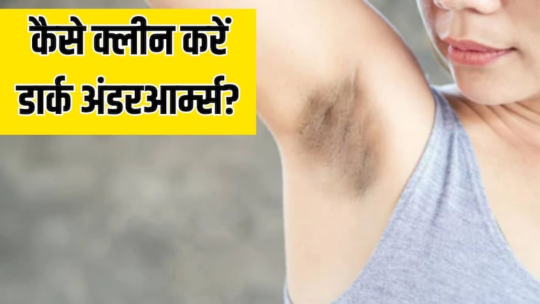 डार्क अंडरआर्म्स के कारण हाथ उठाने में आती है शर्म? डर्माटोलॉजिस्ट के ये 7 टिप्स आएंगे काम, साफ हो जाएगी बगल डार्क अंडरआर्म्स के कारण हाथ उठाने में आती है शर्म? डर्माटोलॉजिस्ट के ये 7 टिप्स आएंगे काम, साफ हो जाएगी बगल