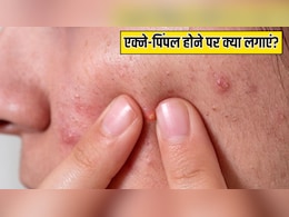 एक्ने-पिंपल होने पर कौन सा सीरम लगाना चाहिए? डर्माटोलॉजिस्ट ने बताया क्या लगाने से एकदम क्लियर हो जाएगी स्किन एक्ने-पिंपल होने पर कौन सा सीरम लगाना चाहिए? डर्माटोलॉजिस्ट ने बताया क्या लगाने से एकदम क्लियर हो जाएगी स्किन