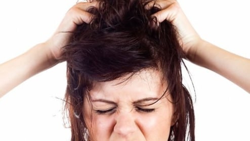 सिर में हो रही है बहुत खुजली क्या करुं? ये 5 नुस्खे तुरंत करेंगे Itching चुटकियों में शांत