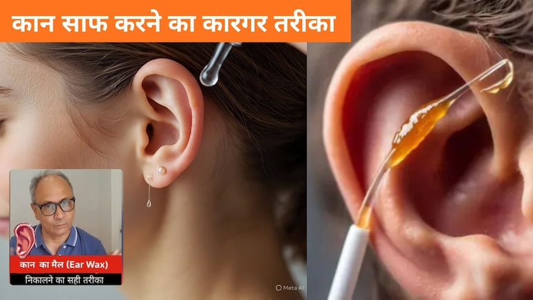 Doctor ने बता दिया कान की गंदगी साफ करने का सबसे आसान तरीका, चुटकियों में निकल जाएगा सारा कचरा