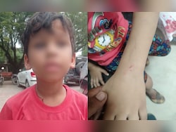 UP Man Makes Pet Dog Attack Child After Guava Falls In His Courtyard