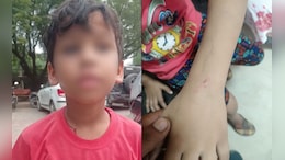UP Man Makes Pet Dog Attack Child After Guava Falls In His Courtyard