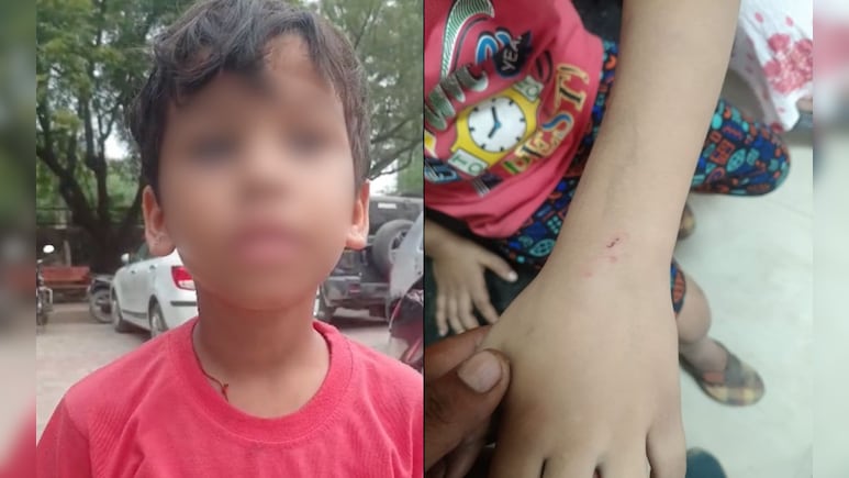 UP Man Makes Pet Dog Attack Child After Guava Falls In His Courtyard
